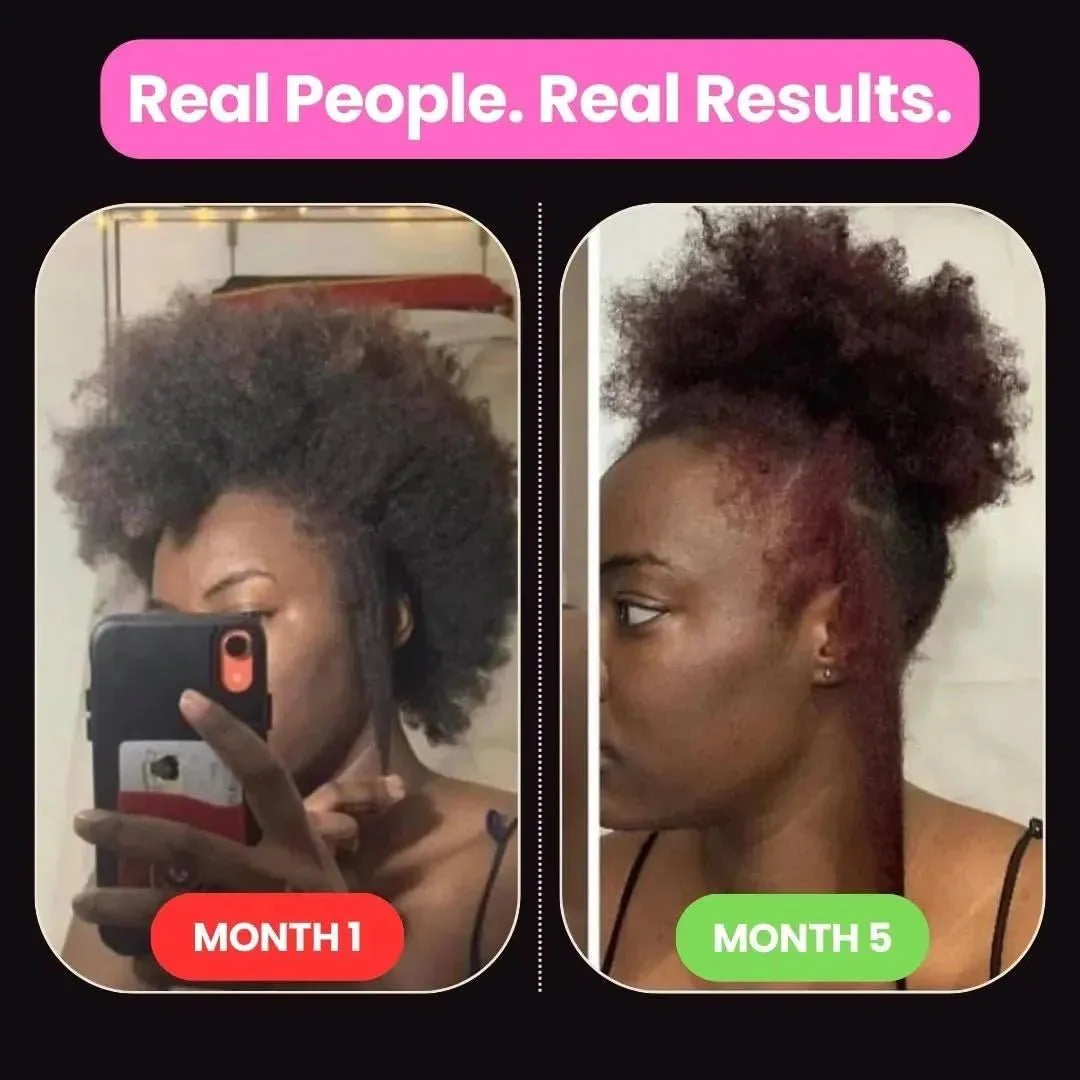 10 in 1 Hair Growth Oil (2 Oz) | Formulated With African Chebe Powder For Extreme Hair Growth, 2 Fl Oz (Pack of 1) - Image 2