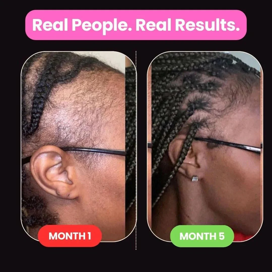 10 in 1 Hair Growth Oil (2 Oz) | Formulated With African Chebe Powder For Extreme Hair Growth, 2 Fl Oz (Pack of 1) - Image 6