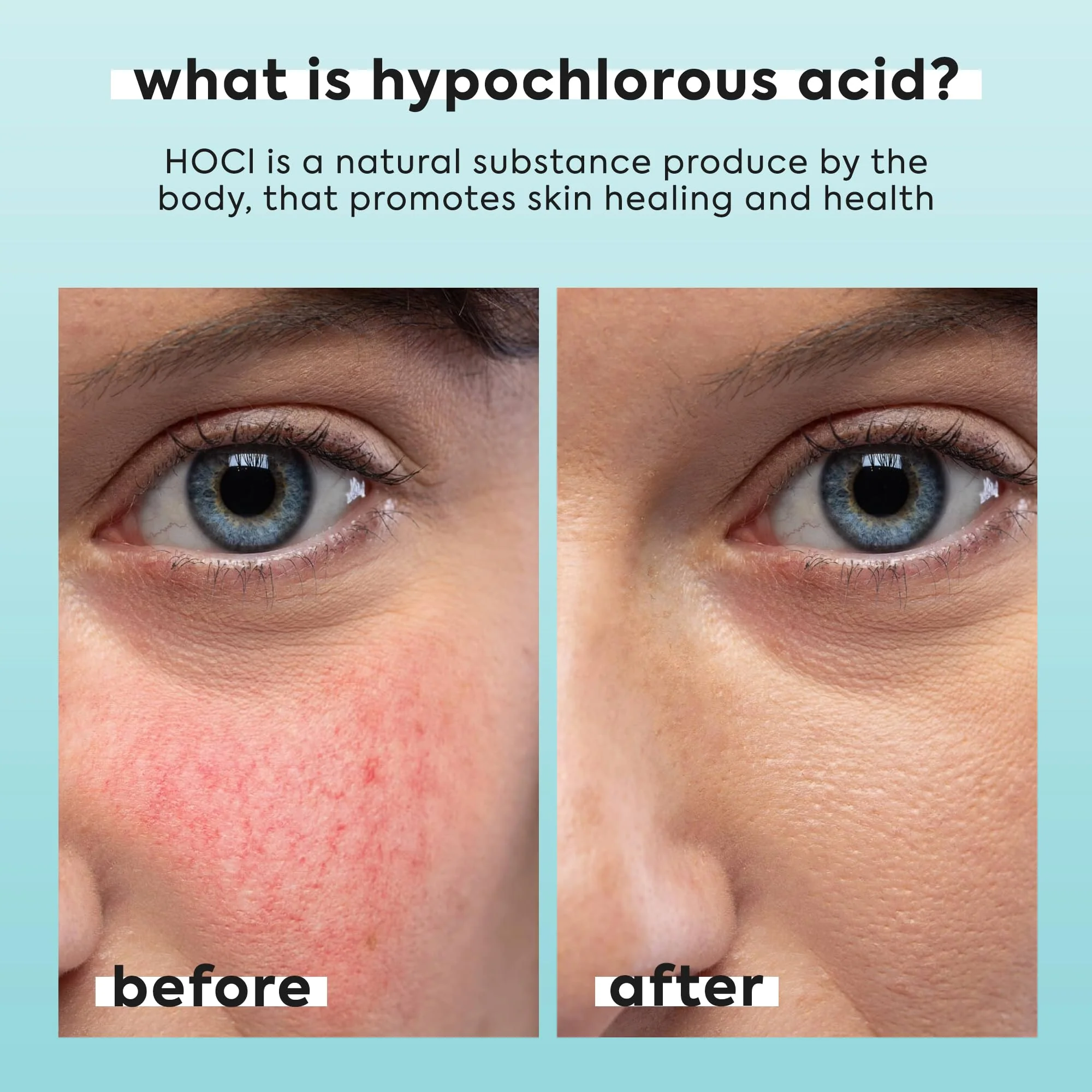 2 Pack Hypochlorous Acid Spray for Face & Body - 2 x 3.4 fl oz - Helps Reduce Redness and Breakouts - Multi-Purpose Travel Size Hypochlorous Spray - Topical Facial Skin Repair - pH-Balancing Toner - Image 8