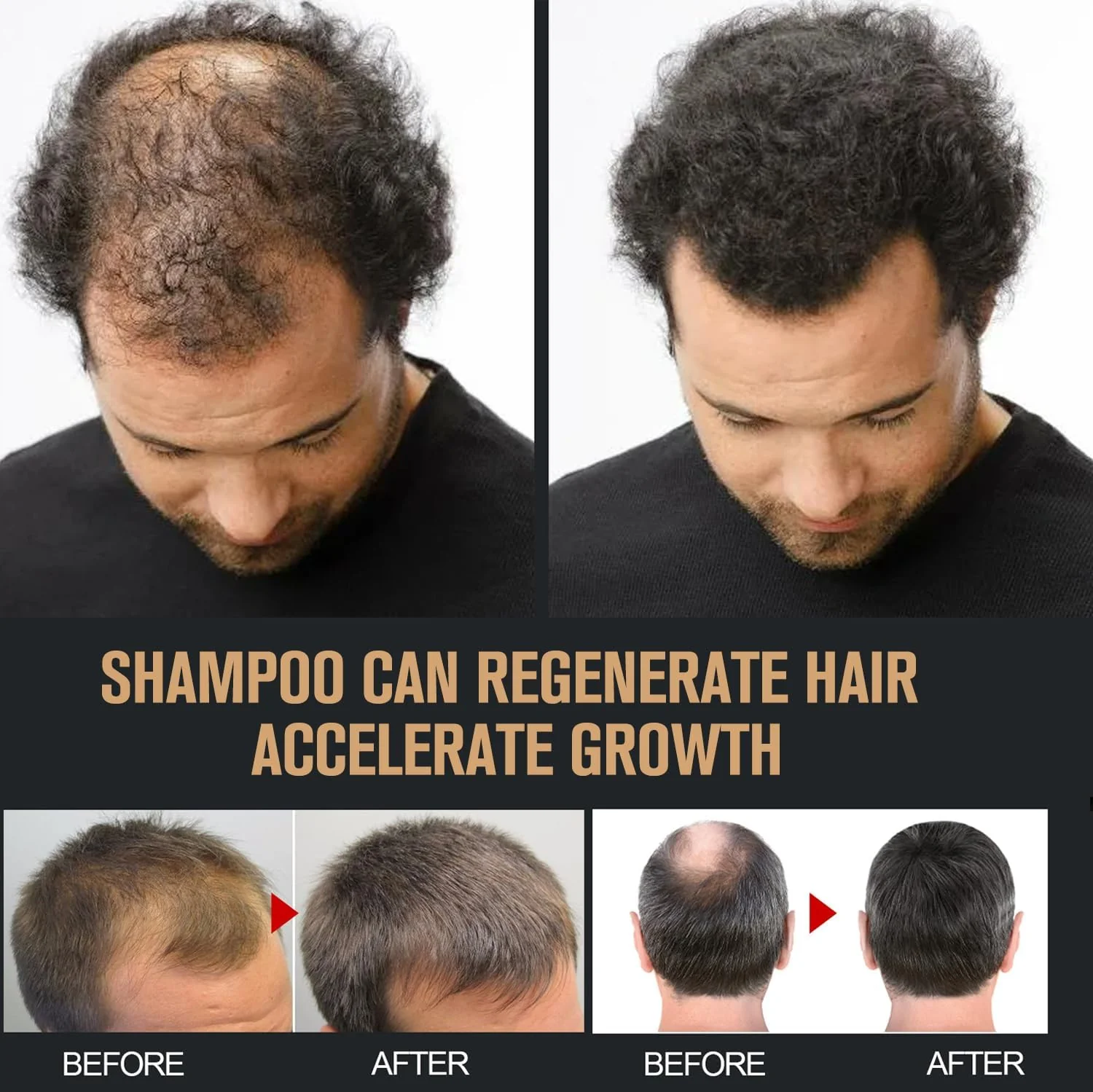 2PCS Root Activator Shampoo, Hair Growth Root Activator Shampoo, for Smooth and Strong Hair Restoration - Image 4
