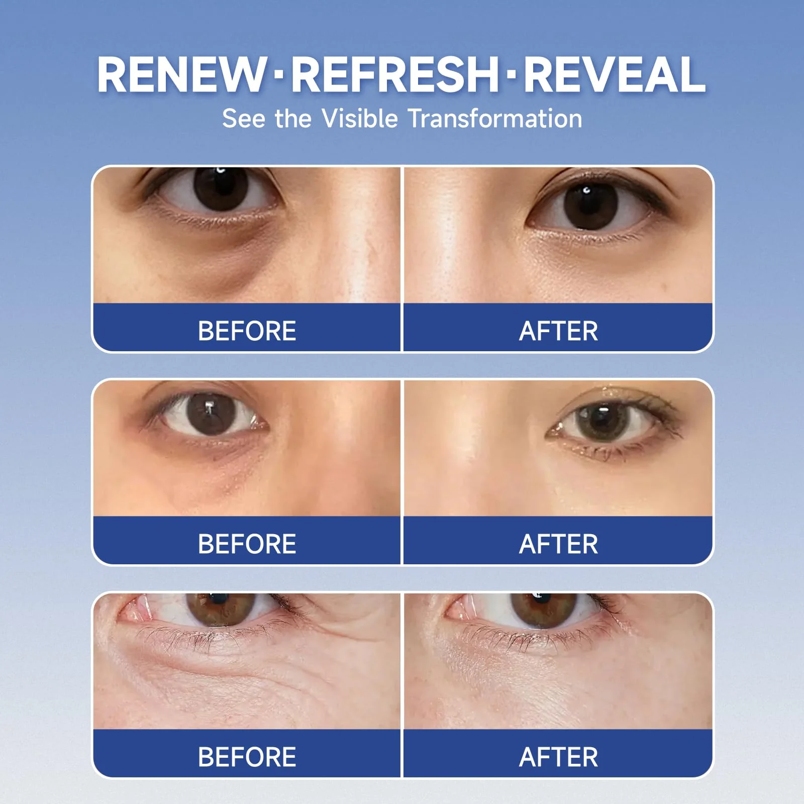 4 pairs PDRN & Calcium Micro Eye Patches, Under Eye Patches for Puffy eyes, Dark Circles & Wrinkle | Hyaluronic Acid, Kojic Acid, Collagen, Peptides, Vitamin C, Niacinamide - Korean Popular Eye Care - Image 3