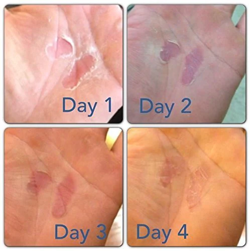Hand Tear Repair - Rip Fix Stopper Balm for Gymnastics - Climbers Hand Balm - Wod Callus Hand Care - Climbing Hand Repair Balm Cream - Treatment for Cracked or Ripped Hands Classic 1.34 oz Tin - Image 5