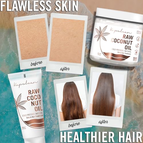 Raw Coconut Oil for Skin, Hair – Raw Extra Virgin Coconut Oil - Pure Unrefined Cold Pressed Oil with MCTs for Body Care, Hair Growth, Aceite de Coco Natural, Baby, Dogs, Pets 200ml - Image 6