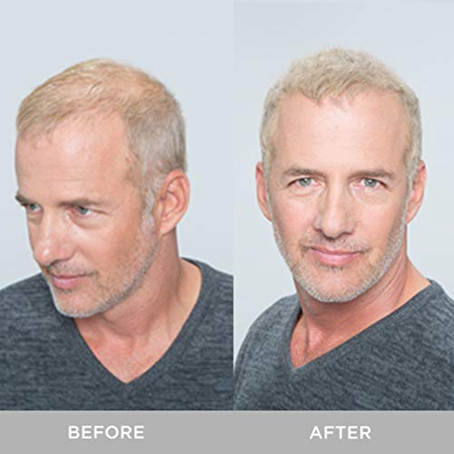 XFusion Keratin Hair Fibers - Image 4