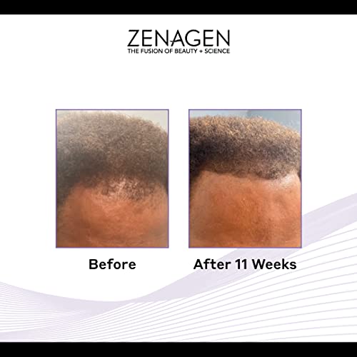 Zenagen Revolve Thickening Hair Loss Treatment for Men - Image 2