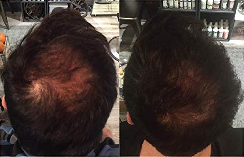 Zenagen Revolve Thickening Hair Loss Treatment for Men - Image 5