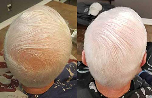 Zenagen Revolve Thickening Hair Loss Treatment for Men - Image 6