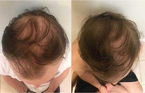 Zenagen Revolve Thickening Hair Loss Treatment for Men - Image 7
