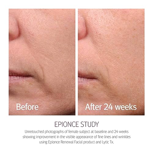 Epionce Renewal Facial Lotion - Hydrating, Anti-Aging Moisturizer for Normal to Combination Skin, For Fine Lines & Wrinkles, Dermatologist Skincare - Image 9
