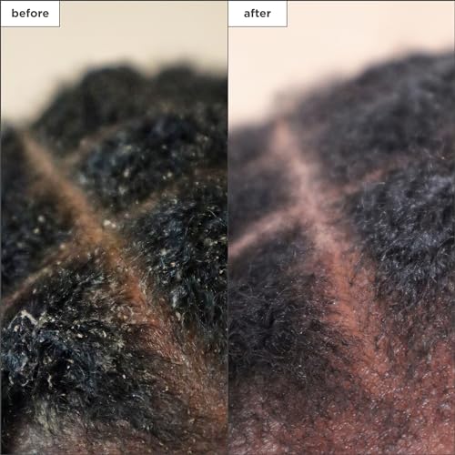 Briogeo Scalp Revival Charcoal + Tea Tree Scalp Treatment, Scalp Serum to Soothe a Dry, Flaky, Itchy Scalp, Absorb Oil, Hydrate Dry Scalp, Clarify Build Up, Vegan, Cruelty-Free, 1 fl oz - Image 3