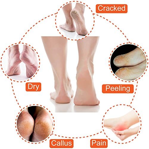 Selizo 5 Pairs Moisturizing Gel Heel Socks Open Toe Socks for Dry Hard Cracked Heels, 5 Colors - Image 6