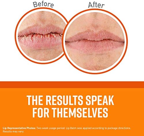 O'Keeffe's Lip Repair Lip Balm for Dry, Cracked Lips, Stick, (Pack of 3: 1 Cooling + 1 Unscented + 1 SPF) - Image 2