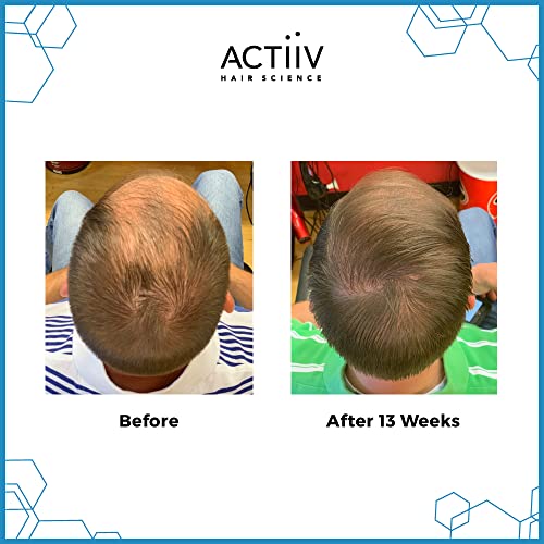 ACTIIV Recover Thickening Cleansing Hair Loss Shampoo Treatment for Men(Packaging May Vary) - Image 2
