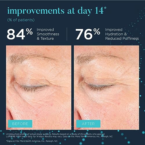Neocutis Lumiere Firm - Illuminating and Tightening, Anti-Aging Eye Cream - Brighten, Hydrate, and Soothe - for Dark Circles, Puffiness, and Wrinkle Prevention - Travel-Friendly - 15 ml/0.5 fl oz. - Image 8