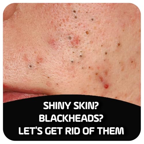 Asepxia Activated Charcoal Cleansing Bar for Enhanced Acne Control & Skin Purification with 2% Salicylic Acid, Ideal for Oily Skin and Reducing Blackheads - 4 Oz, 5-Pack - Image 2