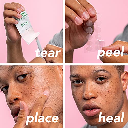 Mario Badescu Drying Patch Blemish Covering, Invisible Spot Treatment, Absorbing All Day Polymer Adhesion with Vitamin C, Vegan & Cruelty Free, Strong Hold (60 Patches, 12mm), Clear - Image 6