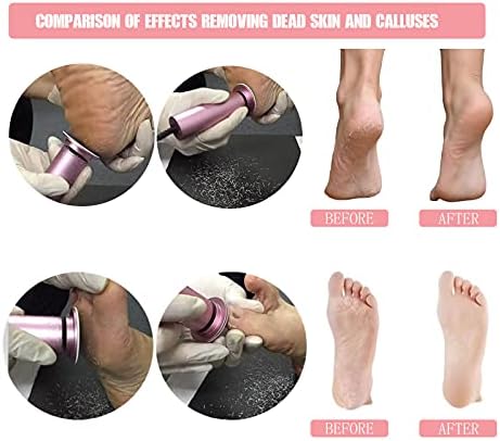Electric Foot File Callus Remover Professional Foot File Pedicure Tools Adjustable Speed 120pcs Replacement Sandpaper disc Easy to Remove Cutin Dead Skin calluses(Black 120pcs) - Image 2