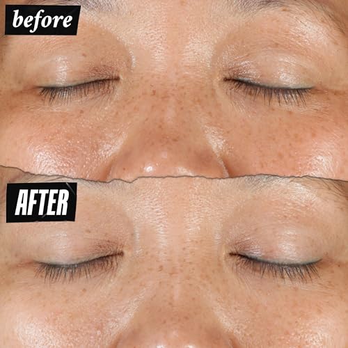 Kiehl's Clearly Corrective Dark Spot Serum, Brightening Facial Serum, Reduces Hyperpigmentation & Post-acne Marks, with Vitamin C & Salicylic Acid, All Skin Types, Paraben-free, Mineral Oil-free - Image 4