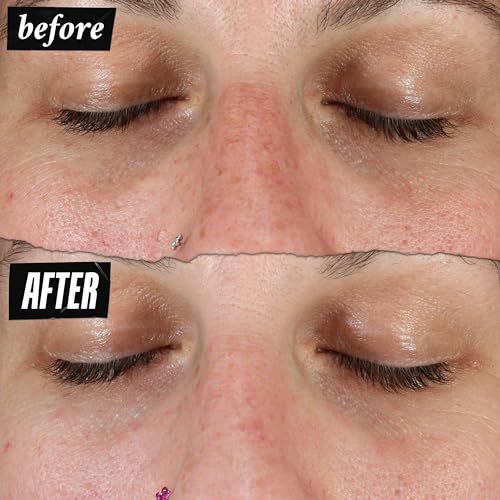 Kiehl's Clearly Corrective Dark Spot Serum, Brightening Facial Serum, Reduces Hyperpigmentation & Post-acne Marks, with Vitamin C & Salicylic Acid, All Skin Types, Paraben-free, Mineral Oil-free - Image 5