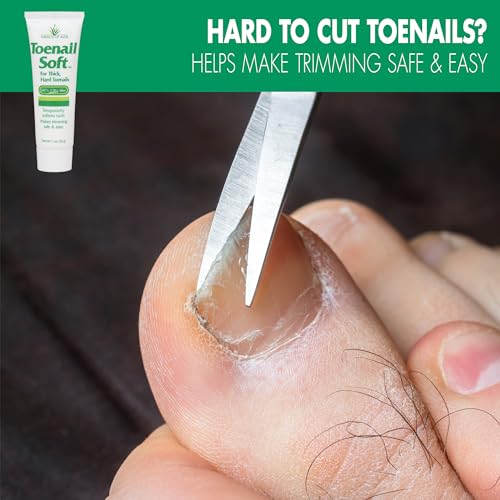 Toenail Soft Temporary Nail Softening Cream for Thick, Hard Toenails with Aloe 1 Oz - Image 2