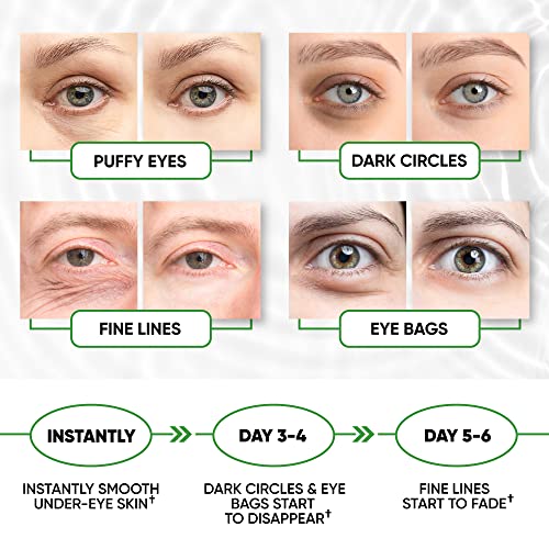 Under Eye Patches for Puffy Eyes, Dark Circles, Undereye Bags - Green Tea Skincare Treatment Mask for Wrinkles, Puffiness Reducer - Hyaluronic Acid, Collagen,Caffeine - Gifts for Women & Men - 60 Pads - Image 6