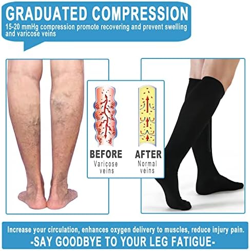 2 Pairs Medical Zipper Compression Socks 15-20mmHg for Women&Men, Knee High Compression Stockings - Image 3