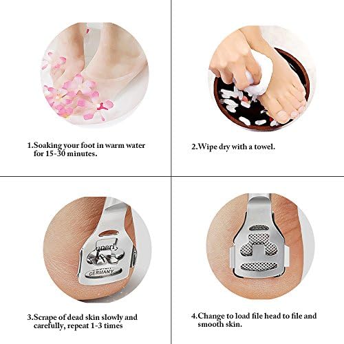 ZIZZON Foot Care Pedicure Callus Shaver Hard Skin Remover Wood Handle 70 Blades - Image 7