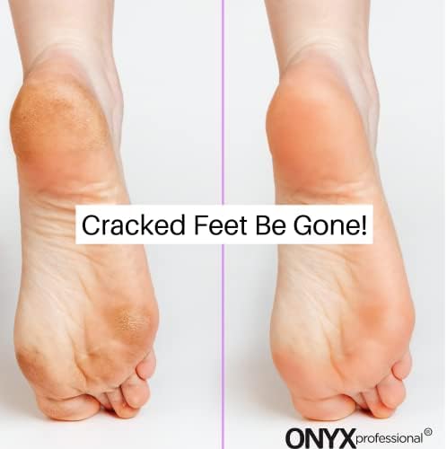 Onyx Professional Gel Moisturizing Socks, One Size Dry Feet Treatment for Women or Men, Hydrating Spa Socks for Dry Feet and Cracked Heel Repair, One Reusable Pair - Image 7