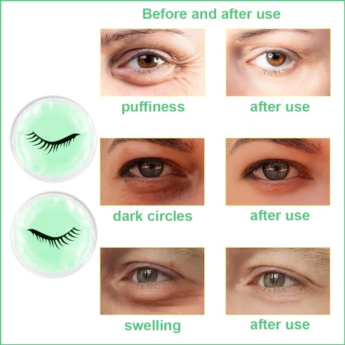 Face Eye Masks for Dark Circles and Puffiness, Migraines, Headache, Stress, Redness, Acne, Cooling Face Masks for Women Man, Hot Cold Use Ice Face Mask. (Green) - Image 6