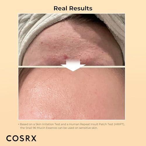 COSRX Best Seller Duo- Snail 92 Cream & Snail 96 Essence, Daily Face Gel Moisturizer and Hydrating Serum for Face with Snail Secretion Filtrate, Korean Skin Care - Image 5