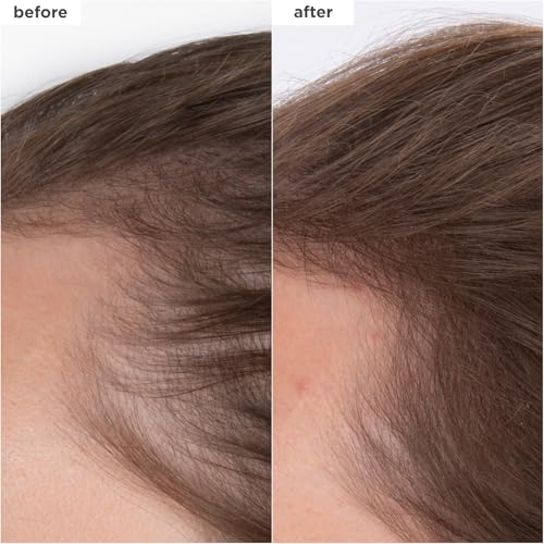 Briogeo Destined For Density MegaStrength+ Caffeine + Biotin Peptide Density Serum, Increases Hair Thickness and Density, Fast-Absorbing & Non-Greasy, Fragrance-Free, Vegan, Cruelty-Free, 1.5 fl oz - Image 2