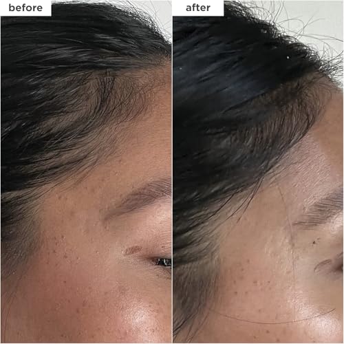 Briogeo Destined For Density MegaStrength+ Caffeine + Biotin Peptide Density Serum, Increases Hair Thickness and Density, Fast-Absorbing & Non-Greasy, Fragrance-Free, Vegan, Cruelty-Free, 1.5 fl oz - Image 4