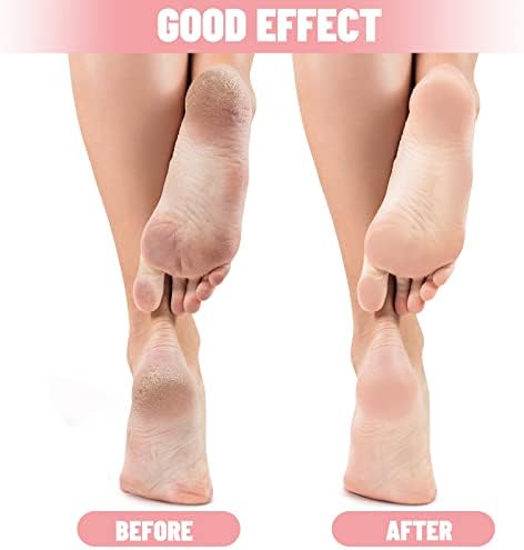 Tarpop 3 Pairs Aloe Socks Women Moisturizing Spa Socks for Dry Cracked Heel Feet Infused Gel Sleeping Fuzzy Lotion Valentines Day Gift for Women Men Softening Dry Feet(Pink) - Image 4