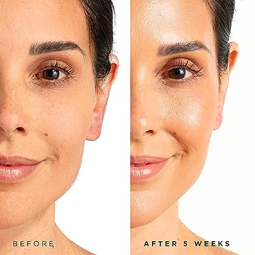 Tree of Life Beauty Hydrating Facial Serum - Pro Collagen Peptides with Argireline & Replexium - Anti Aging & Wrinkle Reduction - Dermatologist-Tested - 1 Fl Oz - Image 3