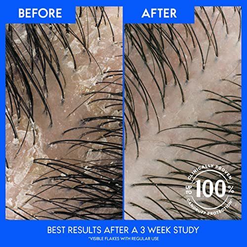 Head and Shoulders Shampoo, Daily-Use Anti-Dandruff Paraben Free Treatment, Dry Scalp Care with Almond Oil, 32.1 fl oz, Twin Pack (Pack of 4) - Image 4