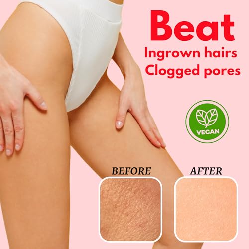 Bikini Area Exfoliator, 2% Kojic Acid Vitamin C & 7% AHA/BHA Even Skin Tone & Ingrown Hair - Underarm Scrub - Radian, Smoothe & Soften Body Scrub - Image 4