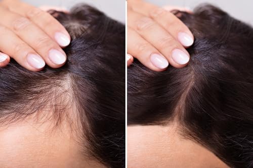 velona Hair Growth Formula - 4 oz | Castor, Amla, Jojoba, Argan, Rosemary, Peppermint, Tea Tree Oils, Vitamin E | Natural Mix with Organic Carrier and Essential Oils - Image 3