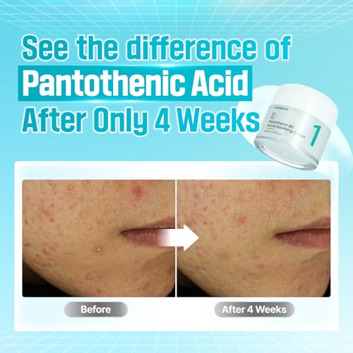 numbuzin No.1 Cream | Pantothenic B5 Active Soothing Cream | Lightweight Hydrating Moisturizer, Pantothenic Acid, Niacinamide | Excess Oil Control, Soothes Acne | Non-Comedogenic | 2.70 fl. oz. - Image 3