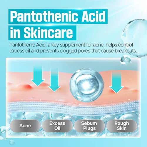 numbuzin No.1 Cream | Pantothenic B5 Active Soothing Cream | Lightweight Hydrating Moisturizer, Pantothenic Acid, Niacinamide | Excess Oil Control, Soothes Acne | Non-Comedogenic | 2.70 fl. oz. - Image 4