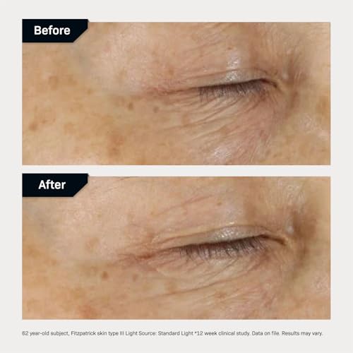 Revision Skincare D·E·J Eye Cream®, Firming and Moisturizing Treatment for Fine Lines, Wrinkles and Crow’s Feet - Image 6