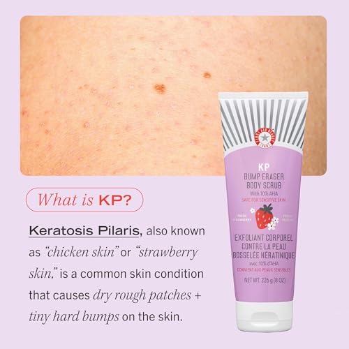 First Aid Beauty - KP Bump Eraser Body Scrub with 10% AHA, Keratosis Pilaris Exfoliater with Glycolic and Lactic acids, Helps Reduce Chicken Skin Bumps, Safe for Sensitive Skin, Strawberry Scent, 2 oz - Image 8