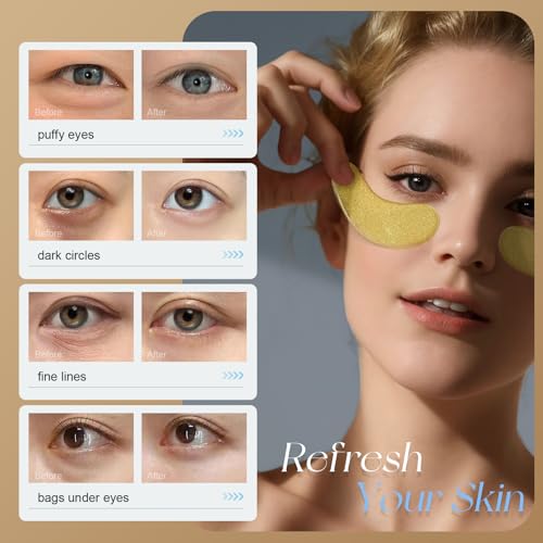 Mimido Under Eye Patches - Eye Patches for Puffy Eyes, eye masks for dark circles and puffiness (30 Pairs) - Image 3