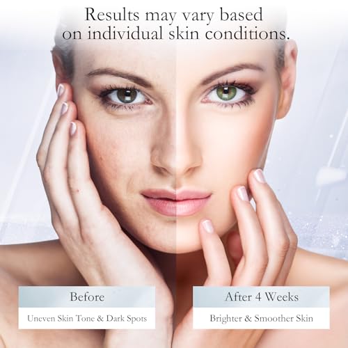 Dark Spot Remover for Face,Facial Dark Spot Remover for Sun Spots Age Spots Brown Spots,Body Dark Spots Remover Skin for Hands Underarm Legs (0.5 Fl Oz) - Image 3
