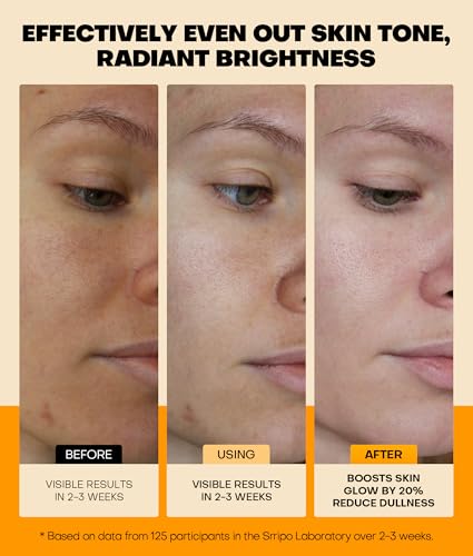 Pure Natural Skin Brightening & Anti Aging 20% Vitamin C Serum, Collagen Peptide Infused Face Serum for Deep Hydration, All-in-One Serum with Niacinamide, Retinol, Hyaluronic Acid, 2.02 Fl Oz - Image 4