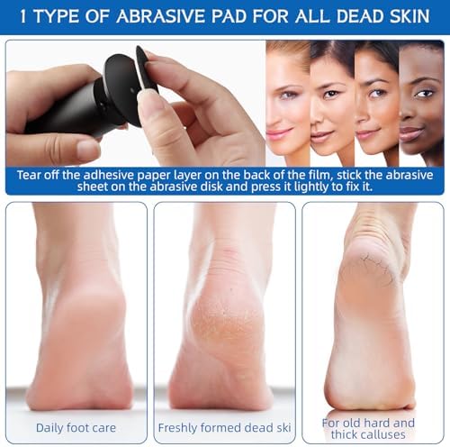 Electric Foot Filer-Electric Foot Callus Remover, Callus Remover for Feet, Dermave Electric Foot Callus Remover, 60pcs Snding Discs Dead Cracked Skin Calluses for Men/Women (Black) - Image 4