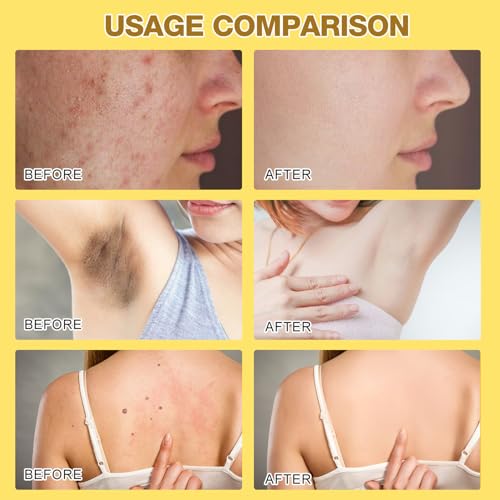 Bee Venom Cream, 2024 New Professional Bee Venom Moisturizing Cream,Bee Venom Moisturizing Gel, Natural Bee Venom Repair Cream, for All Skin Types (2pcs) - Image 4