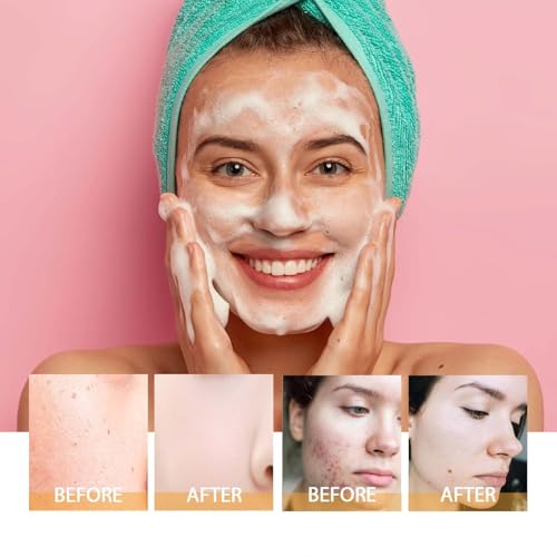 Turmeric Glow Wash Face Wash With Brush, Deep Cleansing Scrub Exfoliating Turmeric Foaming Facial Cleanser For All Skin. (100ml) - Image 5