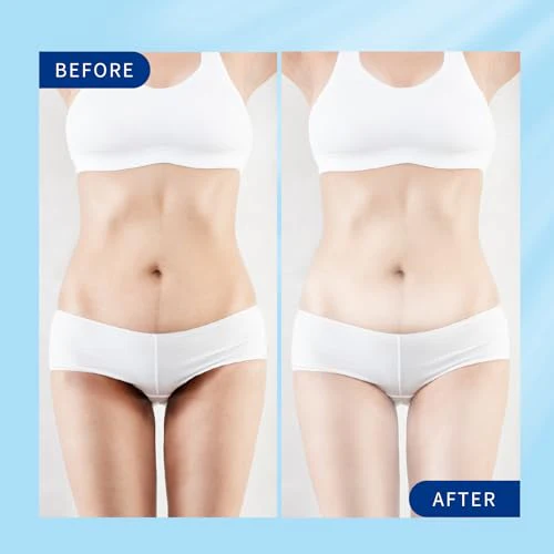 Skin Whitening Cream, Intimate Bleaching Cream for Women, Skin Lightening Cream for Dark Spots, Private Parts, Underarms, Elbows, Armpits, Knees, Inner Thighs - Image 3