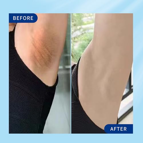 Skin Whitening Cream, Intimate Bleaching Cream for Women, Skin Lightening Cream for Dark Spots, Private Parts, Underarms, Elbows, Armpits, Knees, Inner Thighs - Image 4
