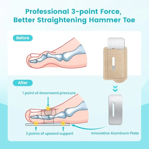 Hammer Toe Straightener Corrector Wrap for Women & Men, Hammer Toe Splint Support - 4 in package - Image 3